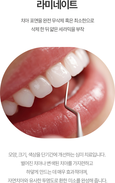 라미네이트 활성화