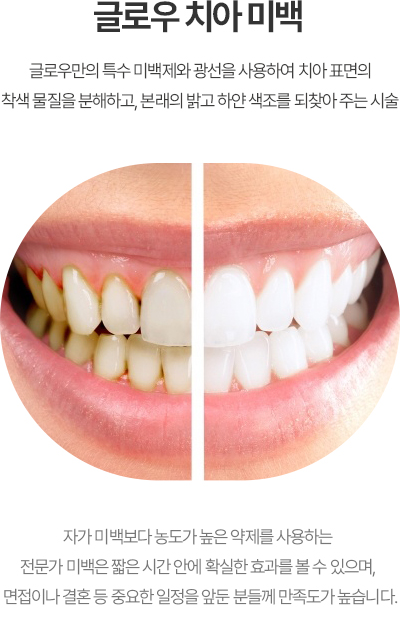 글로우 치아 미백 활성화