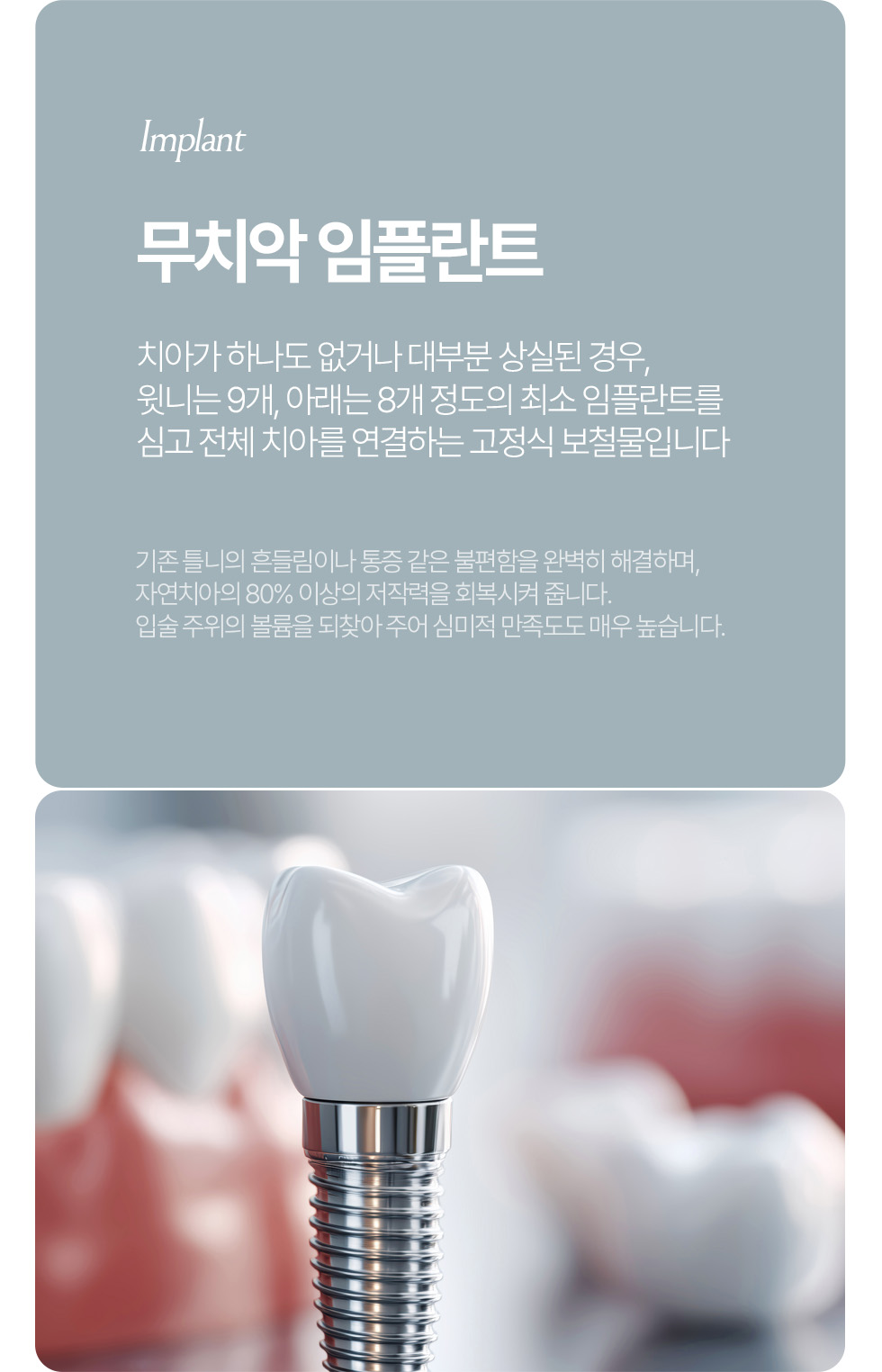 발치 즉시 임플란트